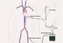 Cardiochirurgia, l’innovazione italiana vince
