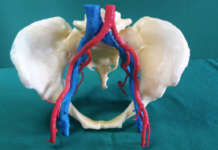 Pianificazione chirurgica con il modello fisico stampato in 3D modello 3D