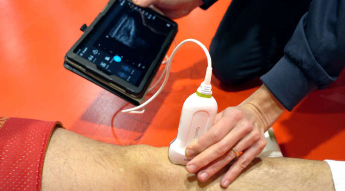 Olimpia Milano Philips Lumify