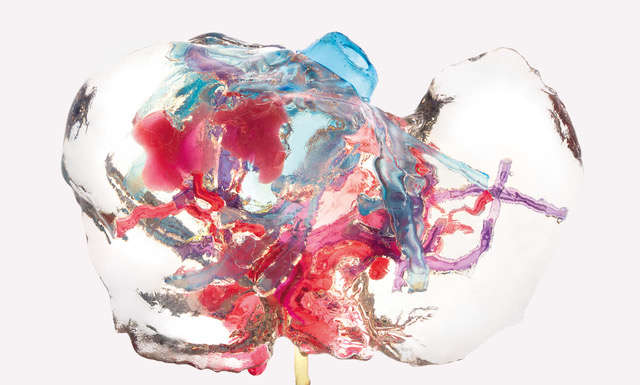 Università degli Studi di Milano PRINTMED-3D_Marco Ferrari