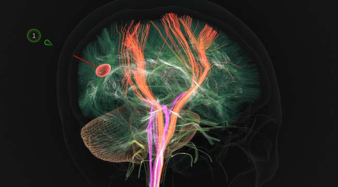 Atlas Meditech Nvidia