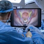 Intelligenza artificiale in sala operatoria: a Londra il primo intervento neurochirurgico assistito in tempo reale