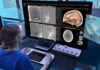 Philips sviluppa un sistema robotico con AI, imaging e cateteri orientabili contro l’ictus