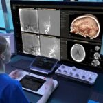 Philips sviluppa un sistema robotico con AI, imaging e cateteri orientabili contro l’ictus