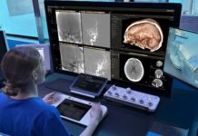 Philips sviluppa un sistema robotico con AI, imaging e cateteri orientabili contro l’ictus