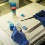 Anatomia patologica digitale, al San Carlo di Nancy l’AI supporta la diagnosi istologica dei tumori