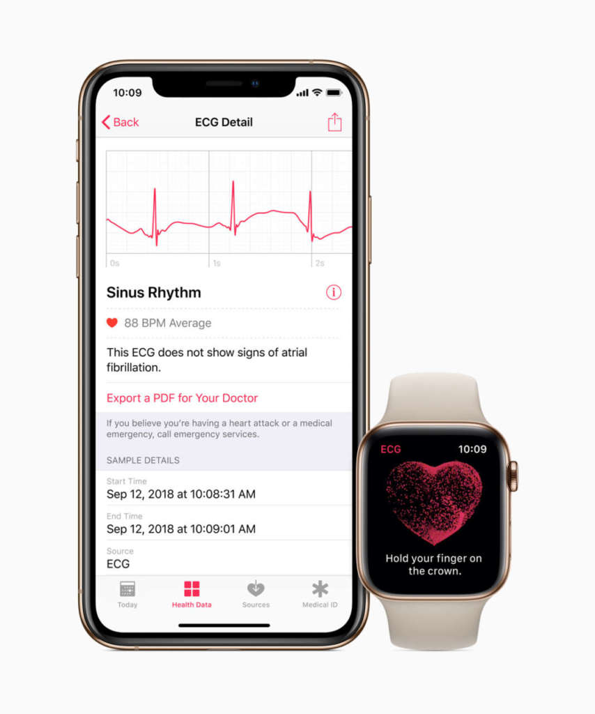 Apple Watch ECG