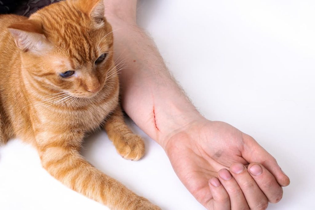 mano malattia graffio gatto