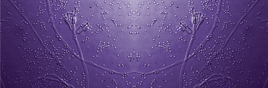 Dai biosensori una nuova corsa all’oro