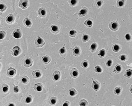 Nanostrutture di dentina, un fenomeno naturale