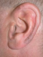 Epilazione 7