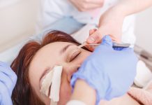 Chirurgia palpebrale, foglie di Catha edulis per ridurre l’edema Chirurgia palpebrale, foglie di Catha edulis per ridurre l'edema