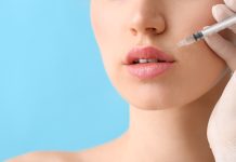 Complicanze da filler: prevenzione e gestione con la ialuronidasi Lifting delle labbra con filler di acido ialuronico e grado di reticolazione