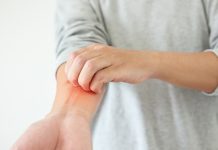 Dermatite atopica: monitoraggio dell’idratazione Trattamenti sistemici per la dermatite atopica