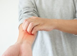 Dermatite atopica: monitoraggio dell’idratazione Trattamenti sistemici per la dermatite atopica