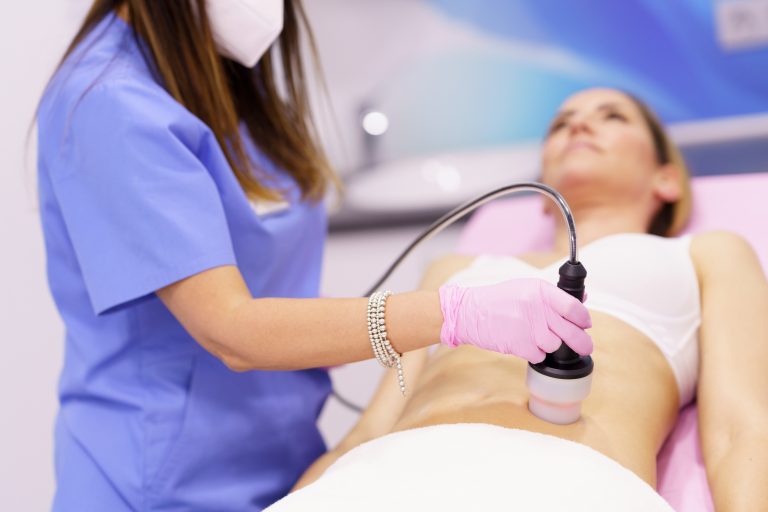 Campi elettromagnetici pulsati e radiofrequenza in seguito a liposuzione