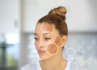 Trend beauty: abitudini e percezioni degli italiani, dalla medicina estetica alla skin quality Anomalie della pigmentazione: cause e trattamenti