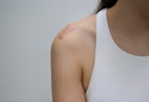 Evidenze genomiche ed epigenetiche delle cicatrici cheloidi Evidenze genomiche ed epigenetiche delle cicatrici cheloidi