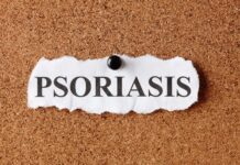 Psoriasi: farmaci biologici o fototerapia? Strategie a confronto Psoriasi: farmaci biologici o fototerapia? Strategie a confronto