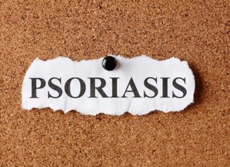 Psoriasi: farmaci biologici o fototerapia? Strategie a confronto Psoriasi: farmaci biologici o fototerapia? Strategie a confronto