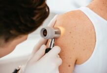 Melanoma, come risconoscerlo: 5 consigli Melanoma, come riconoscerlo: 5 consigli