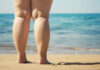 Lipedema: le differenze con l’obesità, i sintomi e i trattamenti Lipedema: le differenze con l'obesità, i sintomi e i trattamenti