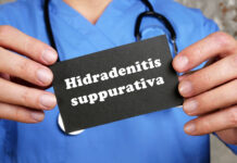 Idrosadenite suppurativa e agonisti GLP-1: effetti clinici Idrosadenite suppurativa e agonisti GLP-1: effetti clinici