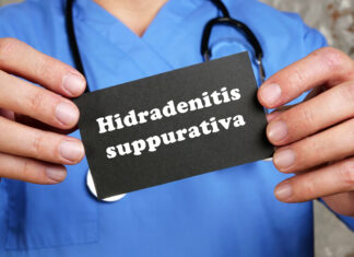 Idrosadenite suppurativa e agonisti GLP-1: effetti clinici Idrosadenite suppurativa e agonisti GLP-1: effetti clinici