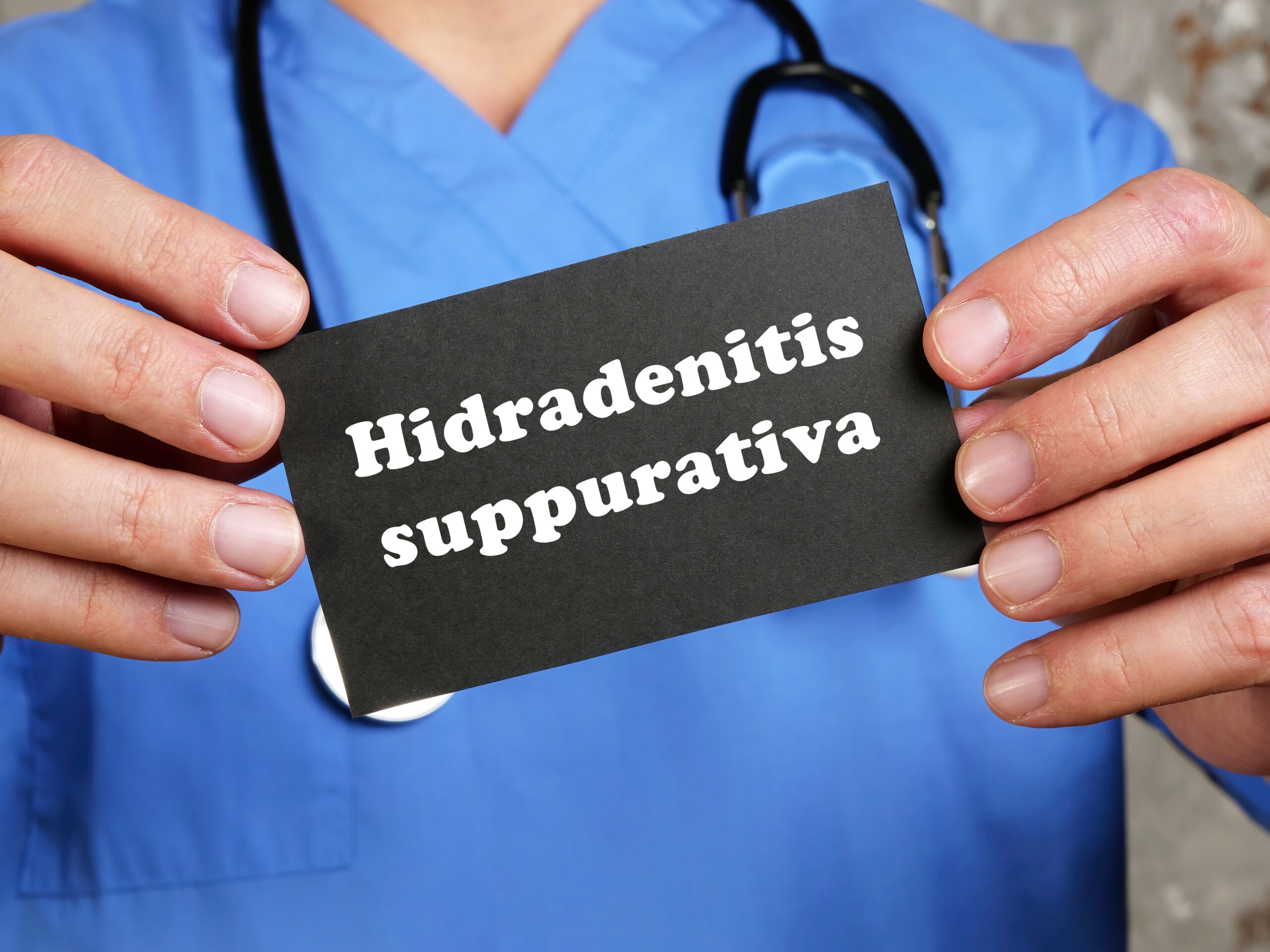 Idrosadenite suppurativa e agonisti GLP-1: effetti clinici Idrosadenite suppurativa e agonisti GLP-1: effetti clinici