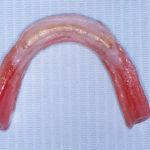 fig. 19