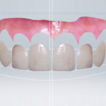 previsualizzazione-grafica