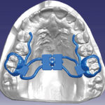 fig_04