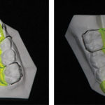 fig_1