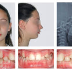 fig_2