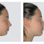 fig_3