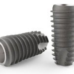 DIOimplant