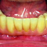 Fig. 9