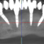 Fig. 10