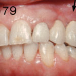 Fig. 10
