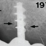 Fig. 11
