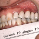 Fig. 12