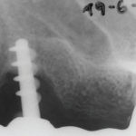 Fig. 13