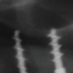 Fig. 14
