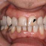 Fig. 15