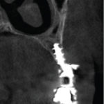 Fig. 18
