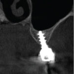 Fig. 19
