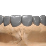 fig. 16