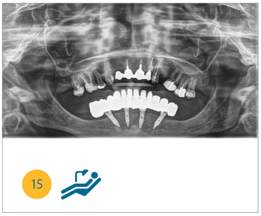 Fig. 15 Ortopanoramica finale.