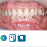 Fig. 2 Situazione clinica iniziale: visione extraorale