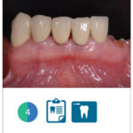 Fig. 4 Situazione clinica iniziale: visione frontale.